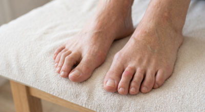 Kladívkové prsty: Jak je poznat, proč vznikají a jak se jich zbavit? | ARNO.cz - obuv s tradicí